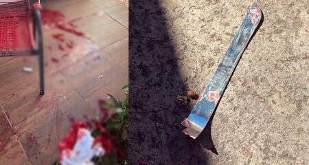 O rapaz foi preso em flagrante e a vítima socorrida pelo Corpo de Bombeiros