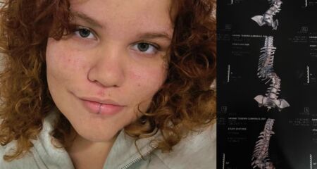 A rotina da jovem precisou ser adaptada por causa das limita&ccedil;&otilde;es