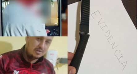 A v&iacute;tima foi diagnosticada com um corte de aproximadamente 15 cent&iacute;metros no lado direito do rosto
