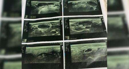 Sem ter com quem deixar filha doente, mulher apenas consegue trabalhar com diárias de limpeza