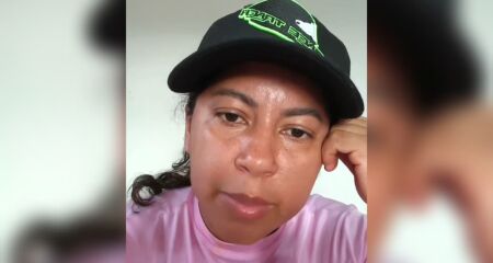 Desempregada, a mulher conta que está sem conseguir trabalhar por causa das dores