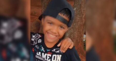 Menino de 11 anos teve 80% do corpo queimado e segue em recupera&ccedil;&atilde;o no CTI 