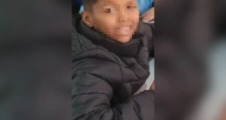 Crian&ccedil;a teve boa resposta &agrave; pele recebida e agora se prepara para uma nova cirurgia na Santa Casa de Campo Grande