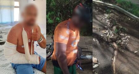 O empres&aacute;rio se machucou na Avenida Nelly Martins e agora aguarda cirurgia enquanto enfrenta dores intensas 