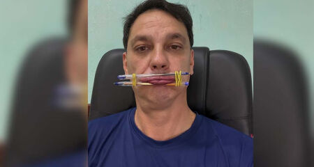 Johnny Guerra (PP) afirmou que improvisou com os objetos enquanto esperava a chegada das 'canetinhas emagrecedoras'