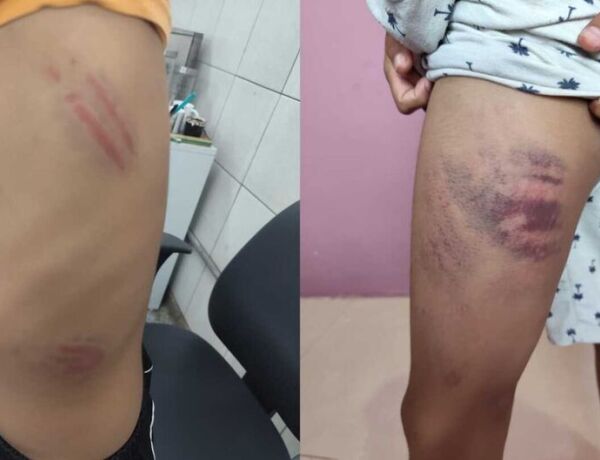 Crian&ccedil;a faz tratamento no CAPS ap&oacute;s ser apontada, junto da m&atilde;e, como autora de agress&otilde;es do colega