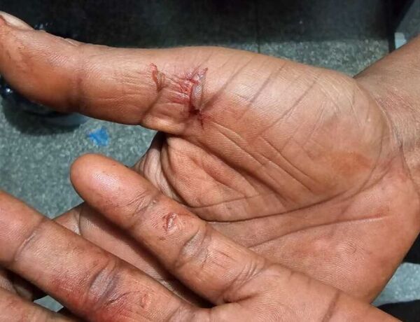 V&iacute;tima tinha medida protetiva contra o suspeito, que foi preso ap&oacute;s resistir &agrave; abordagem policial