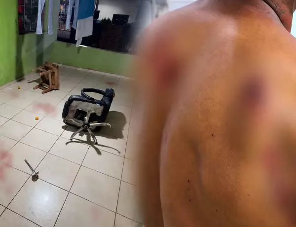 Jovem de 17 anos teria atacado o namorado, de 26, e uma mulher, de 22, ap&oacute;s desentendimento motivado por ci&uacute;mes