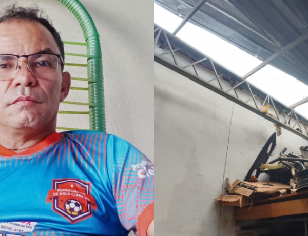 Vilmar Nunes sofreu queimaduras durante acidente enquanto trabalhava na solda de um radiador