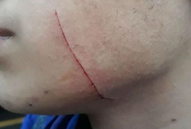 Menino ficou com marcas pelo corpo e olho roxo; homem de 32 anos foi preso ap&oacute;s tentar resistir &agrave; abordagem policial