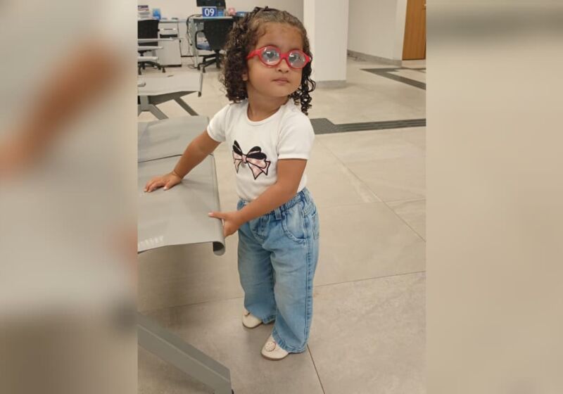 A pequena Liz Sampaio Lino fez a primeira cirurgia ocular aos quatro meses e precisou esperar mais dois anos para dar continuidade ao tratamento 