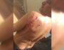 Vídeo: capivara ataca banhista e o deixa ferido em cena inusitada