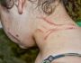 Mulher é agredida a unhadas e quase esfaqueada por prima trans em Campo Grande