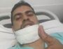 Policial atacado por pitbull consegue tratamento de reconstrução de face