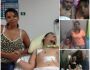 Família de rapaz que teve cabeça quebrada durante parto precisa de ajuda para viver