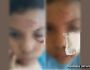 Podia cegar: criança de 8 anos corta o rosto em arame deixado no pátio de escola infantil na Capital