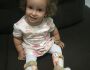 Guerreira, com apenas 1 ano, Maria já passou por 7 cirurgias e família pede ajuda