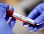 BOLETIM: MS investiga mais 4 casos de Coronavírus, confirma Saúde
