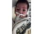 Pequeno Erick nasceu com má formação, está no hospital e precisa de doação de fraldas