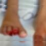 A vítima estava sentada em um deck, com os pés dentro d'água, quando sentiu uma dor forte e viu que parte dos dedos foi arrancada