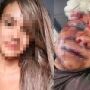 Cirurgia de reconstrução facial ocorrerá na próxima sexta-feira (1&ordm;/8). Em laudo após agressão, foram constatadas diversas fraturas na face
