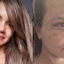 Juliana passou por uma cirurgia de reconstrução facial após sofrer múltiplas fraturas no rosto