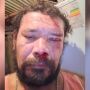 Morador relata momento de terror e revela que já perdeu quatro cães em ataques anteriores