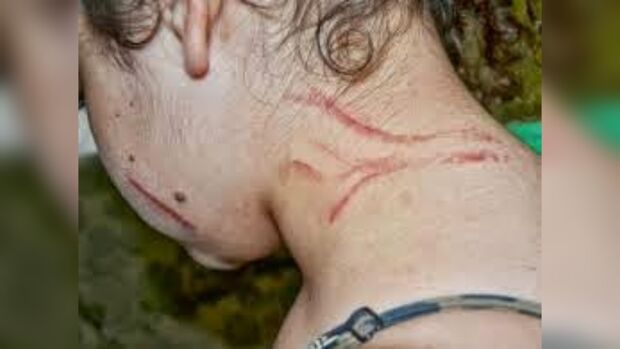 Mulher é agredida a unhadas e quase esfaqueada por prima trans em Campo Grande