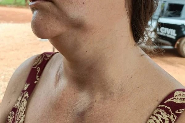 Mulher é agredida pela nora em Corumbá