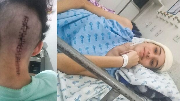 Mãe desempregada pede ajuda para continuar tratamento de filha com tumor maligno em Campo Grande