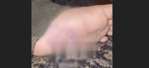 Bebê de 1 ano é espancado e queimado pelos pais no Amazonas