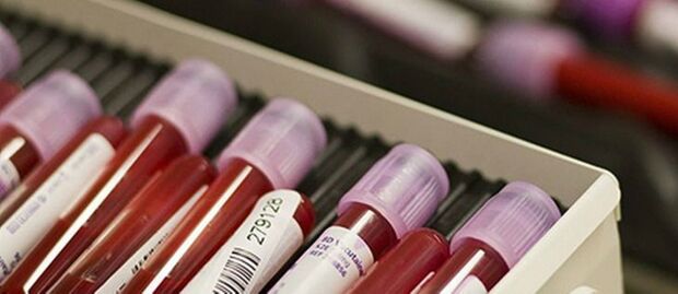SUS oferece novo exame para Hepatite C
