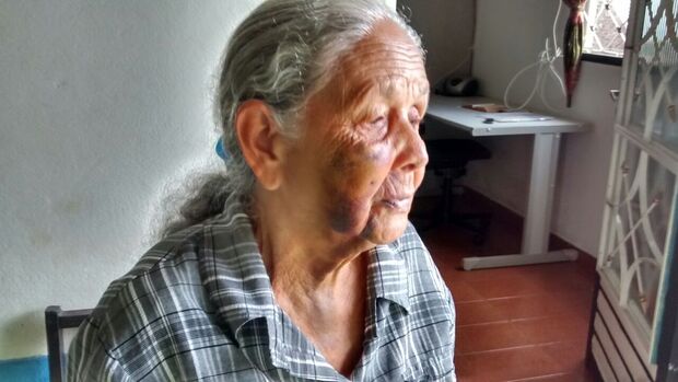 Idosa de 79 anos cai e fratura o rosto em rua sem luz nem asfalto no Parque Lageado
