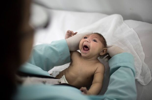 Ministério libera R$ 125 milhões para tratamento de crianças com microcefalia
