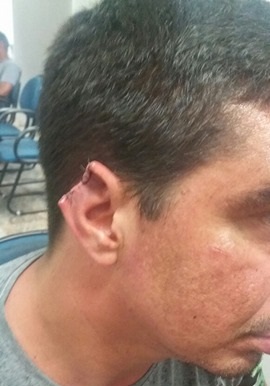 Homem se recusa a pagar espetinho e mulher arranca orelha dele na Vila Jacy