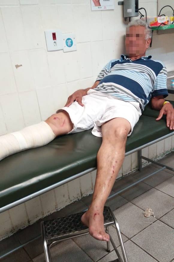 Afastado do trabalho, idoso com pé quebrado agoniza em hospital à espera de cirurgia