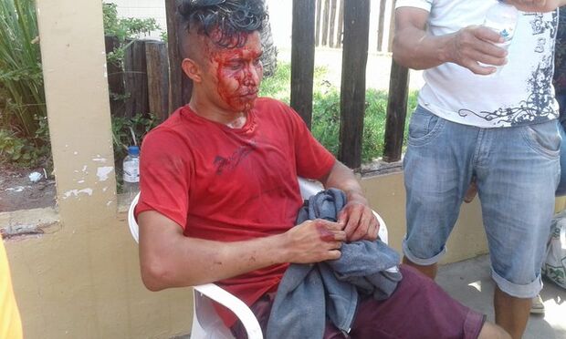 Estudante é assaltado e leva pedrada quando ia fazer prova do Enem 2018, em Macapá