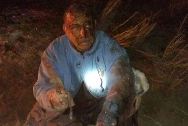 Homem luta com onça-parda para salvar cachorro