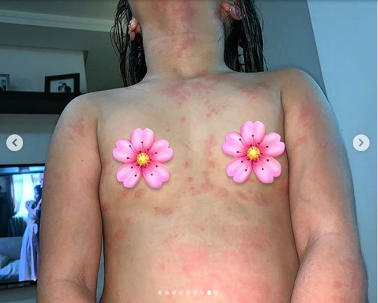 Alerta: criança é internada na UTI após brincadeira com slime