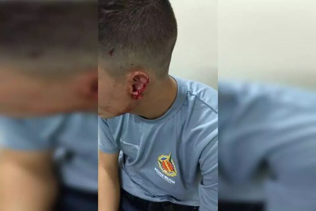 BIZARRO: cadeirante morde e arranca orelha de PM durante abordagem no DF (veja o vídeo)