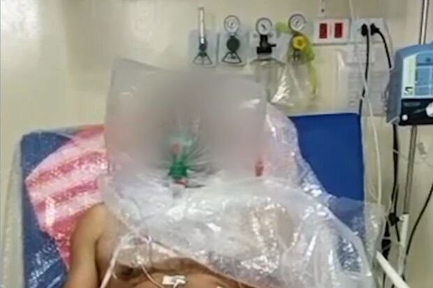 Paciente que aguarda vaga em UTI respira com saco plástico improvisado no AM