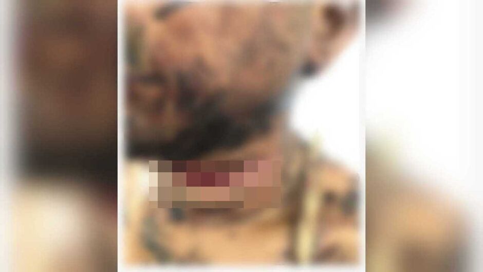 Ele não morreu por milagre