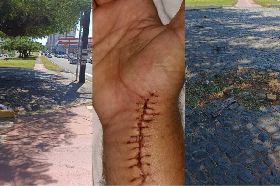 Ciclista quebrou o pulso, passou por cirurgia e faz sessões de fisioterapia