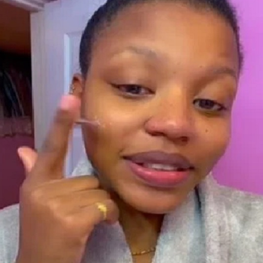 Ela garante que a pelo melhorou