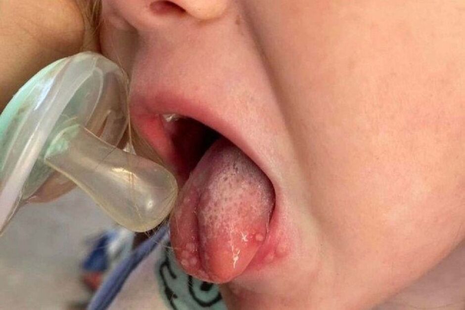 Olha como ficou o estado do bebê