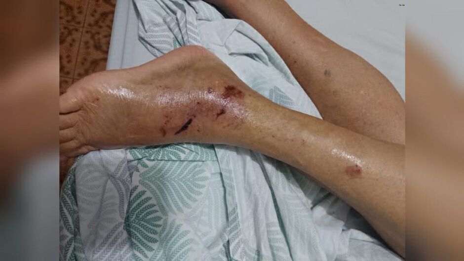 Idosa ficou bastante machucada com episódio