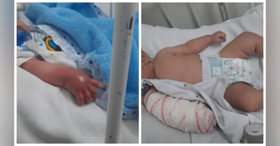 Bebê ficou com braço inchado após erro