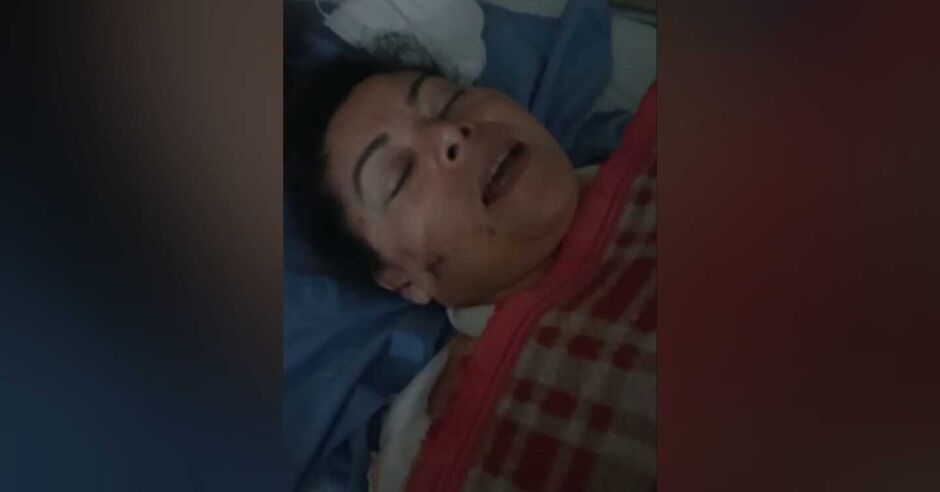 Mulher ficou com as marcas da violência no rosto
