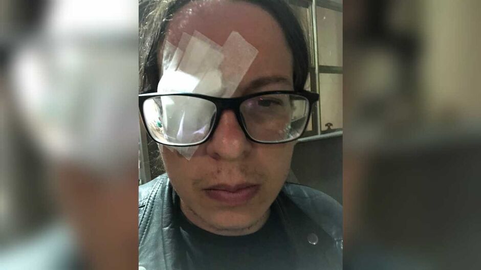 Ricardo precisou de atendimento médico após os fogos caírem em seus olhos