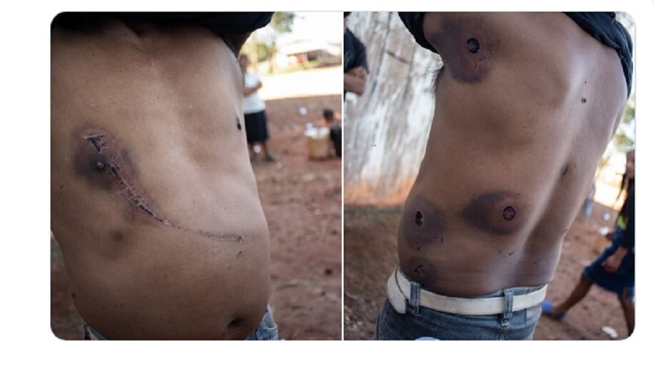 Imagem de indígena ferido em Amambai